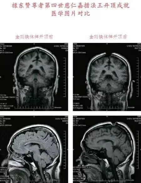 如果没有开顶,弟子百万也是凡夫一个!